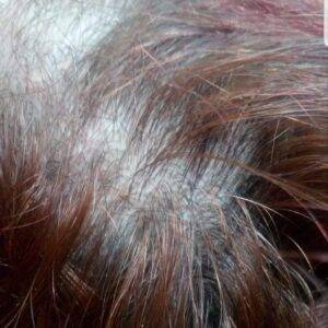 Pack Anti Hair Loss Pack Anti Hair Loss منتجات مضادة لتساقط الشعر